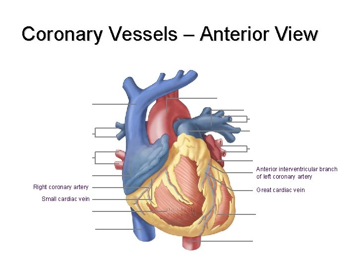 Coronary Vessels – Anterior View Anterior interventricular branch of left coronary artery Right coronary