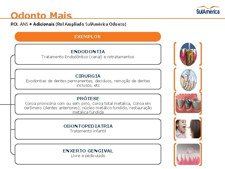 Odonto Mais ROL ANS + Adicionais (Rol Ampliado Sul. América Odonto) EXEMPLOS ENDODONTIA Tratamento