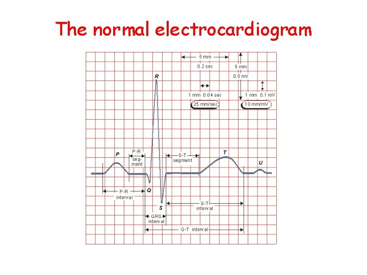 The normal electrocardiogram 