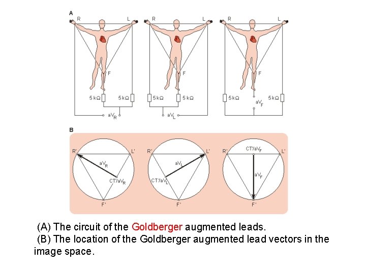(A) The circuit of the Goldberger augmented leads. (B) The location of the Goldberger