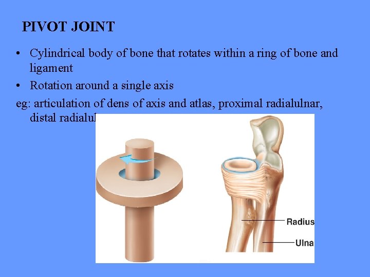 PIVOT JOINT • Cylindrical body of bone that rotates within a ring of bone