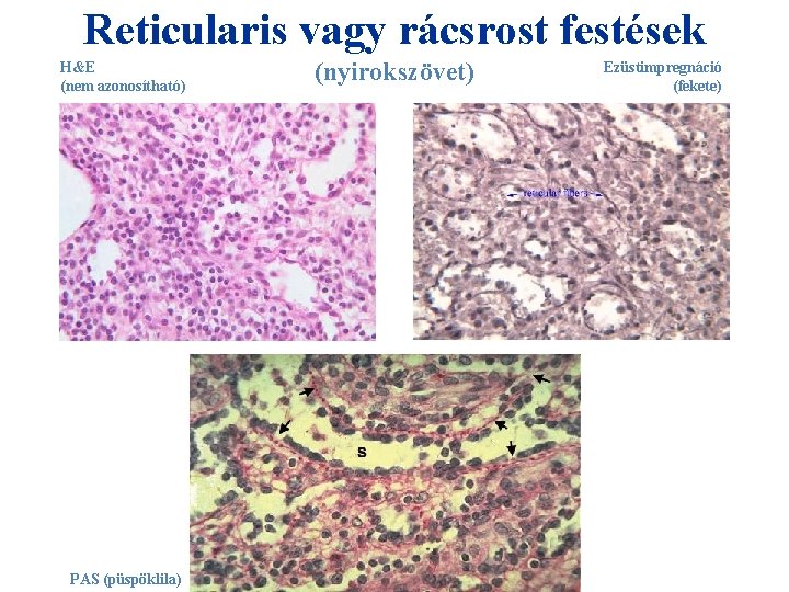 Reticularis vagy rácsrost festések H&E (nem azonosítható) PAS (püspöklila) (nyirokszövet) Ezüstimpregnáció (fekete) 