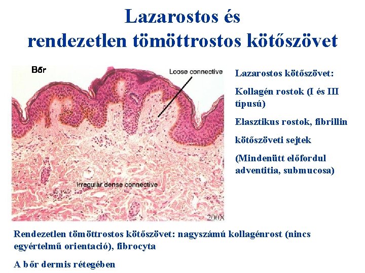 Lazarostos és rendezetlen tömöttrostos kötőszövet Bőr Lazarostos kötőszövet: + HIO 4 = Kollagén rostok