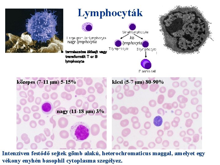 Lymphocyták nagy lymphocyta kis lymphocyta természetes ölősejt vagy transformált T or B lymphocyte közepes