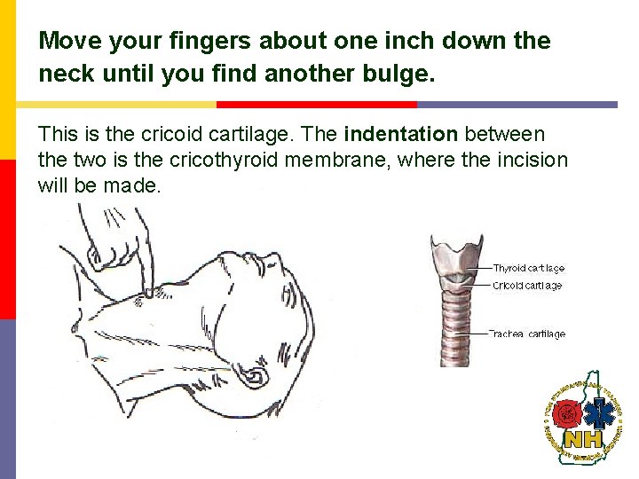 Move your fingers about one inch down the neck until you find another bulge. Move your fingers about one inch down the neck until you find another bulge.