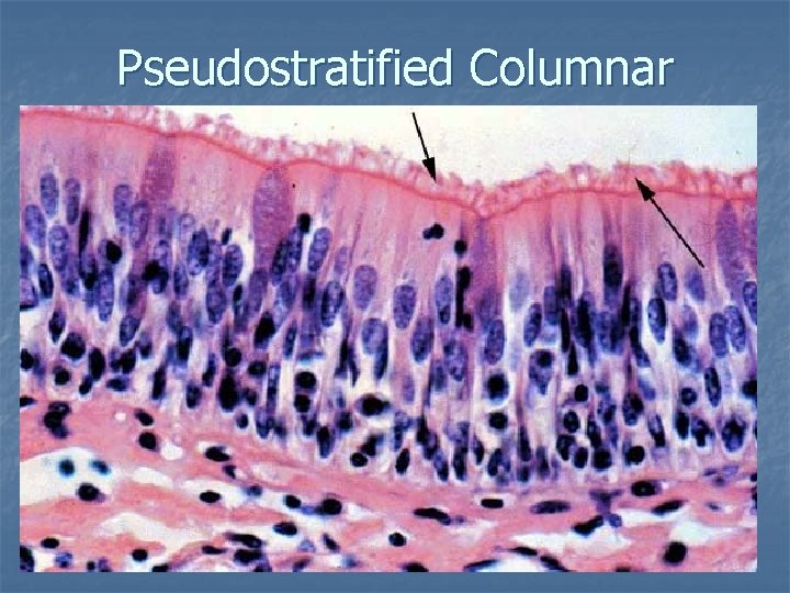 Pseudostratified Columnar 