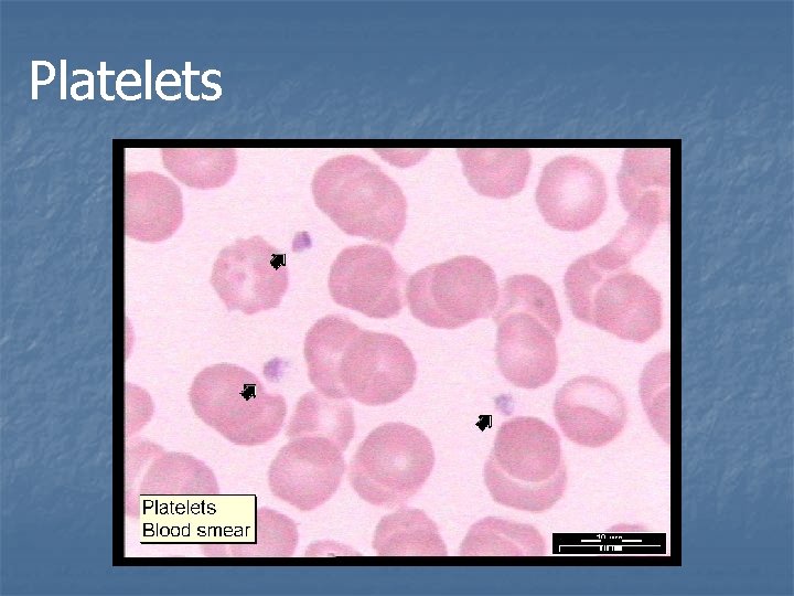 Platelets 