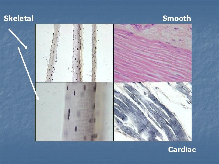 Skeletal Smooth Cardiac 