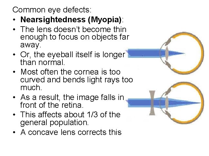 Common eye defects: • Nearsightedness (Myopia): • The lens doesn’t become thin enough to