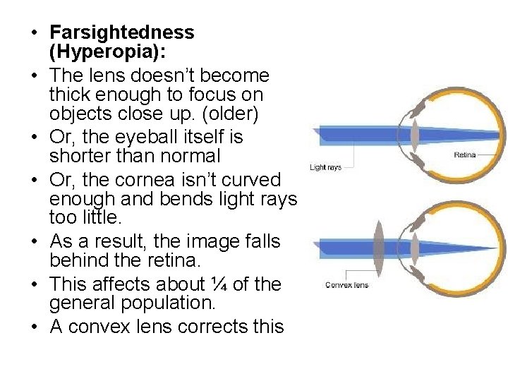  • Farsightedness (Hyperopia): • The lens doesn’t become thick enough to focus on