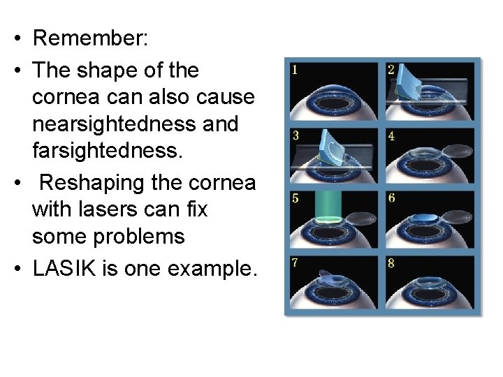  • Remember: • The shape of the cornea can also cause nearsightedness and