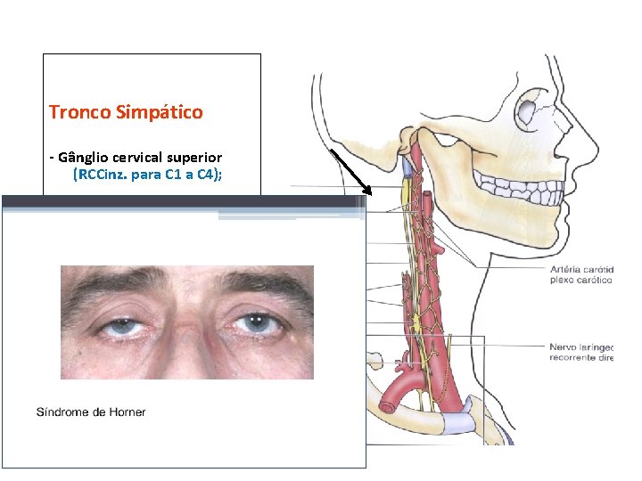 Tronco Simpático - Gânglio cervical superior (RCCinz. para C 1 a C 4); -