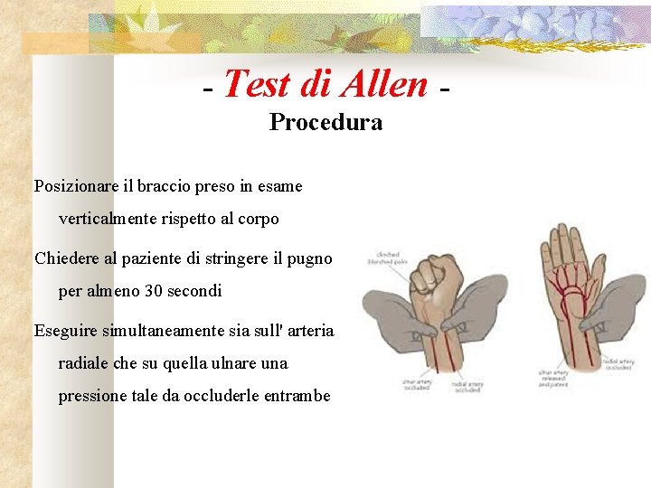 - Test di Allen - Procedura Posizionare il braccio preso in esame verticalmente rispetto