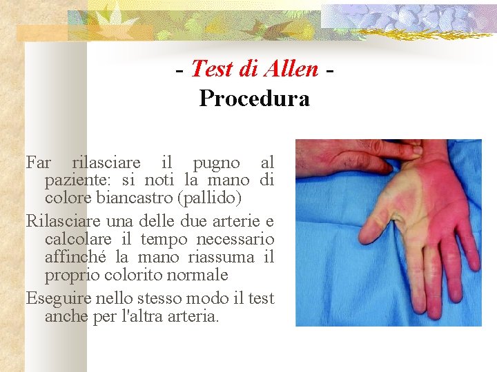 - Test di Allen Procedura Far rilasciare il pugno al paziente: si noti la