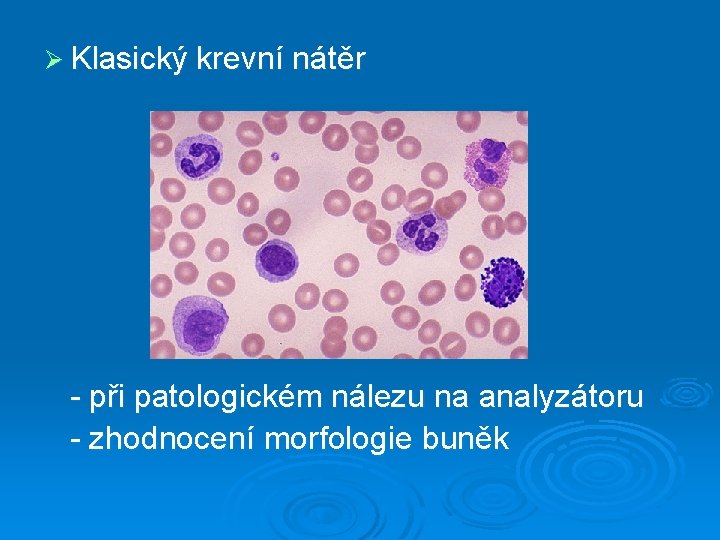 Ø Klasický krevní nátěr - při patologickém nálezu na analyzátoru - zhodnocení morfologie buněk