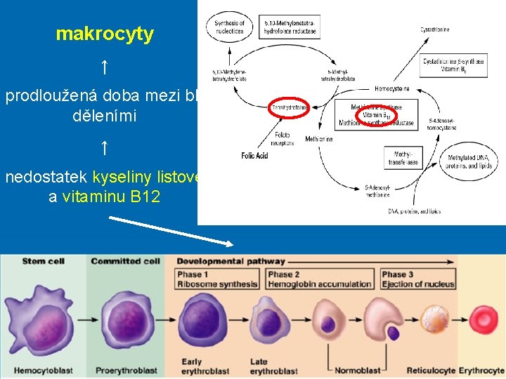 makrocyty ↑ prodloužená doba mezi bb děleními ↑ nedostatek kyseliny listové a vitaminu B