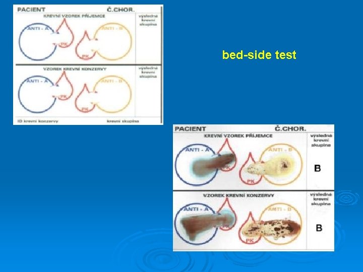 bed-side test 