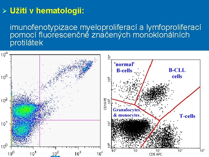 Ø Užití v hematologii: imunofenotypizace myeloproliferací a lymfoproliferací pomocí fluorescenčně značených monoklonálních protilátek 