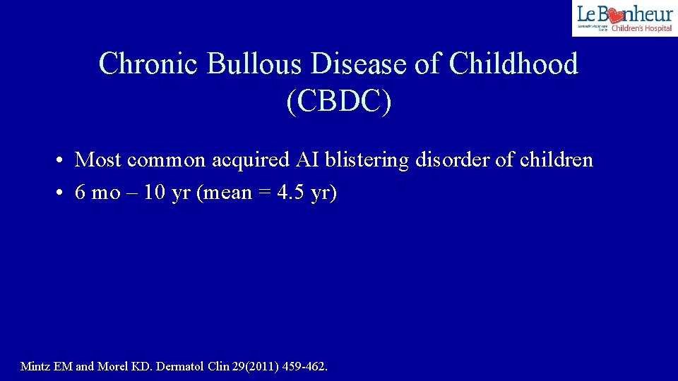 Chronic Bullous Disease of Childhood (CBDC) • Most common acquired AI blistering disorder of