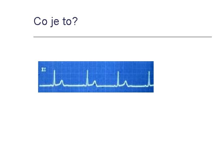 Co je to? 