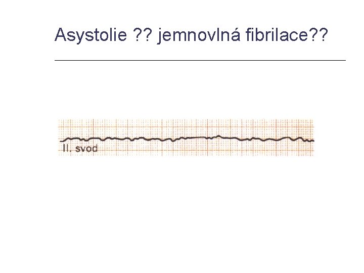 Asystolie ? ? jemnovlná fibrilace? ? 