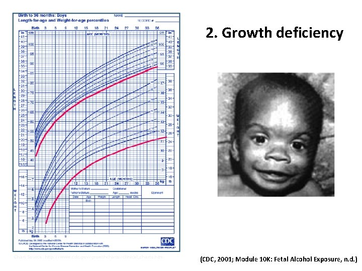 2. Growth Problems 2. Growth deficiency Photo Source: http: //pubs. niaaa. nih. gov/publications/social/Module 10