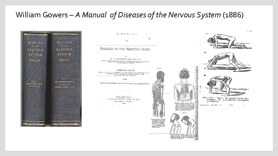 William Gowers – A Manual of Diseases of the Nervous System (1886) 