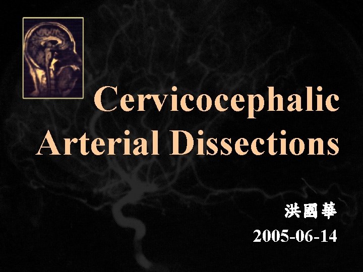 Cervicocephalic Arterial Dissections 洪國華 2005 -06 -14 