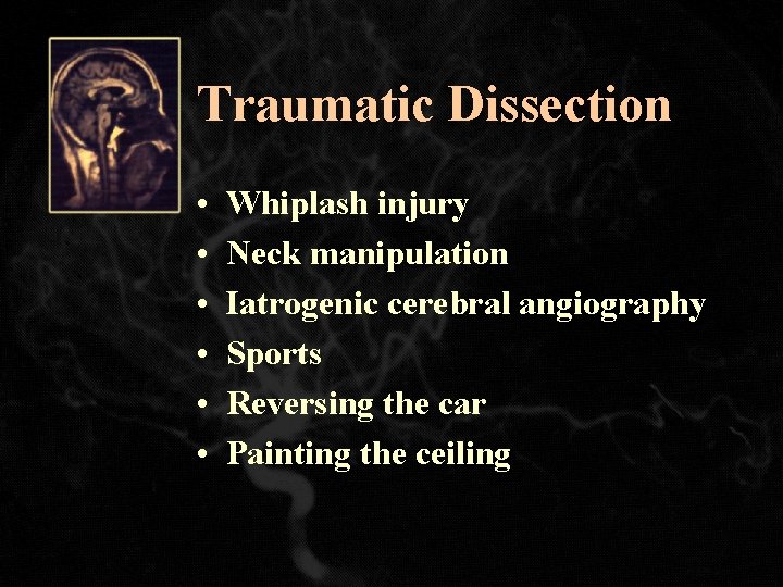 Traumatic Dissection • • • Whiplash injury Neck manipulation Iatrogenic cerebral angiography Sports Reversing