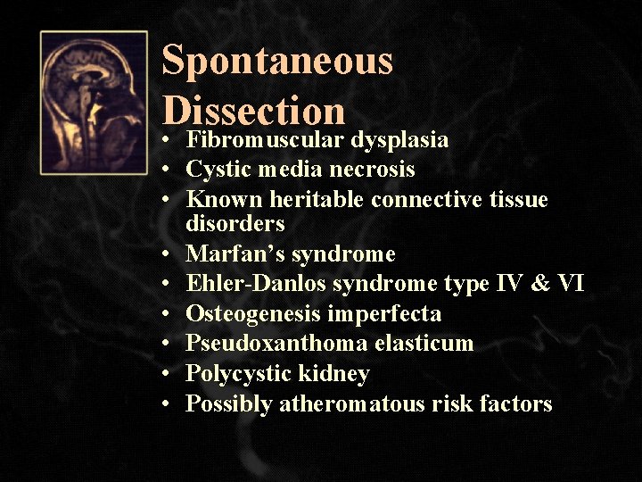 Spontaneous Dissection • Fibromuscular dysplasia • Cystic media necrosis • Known heritable connective tissue