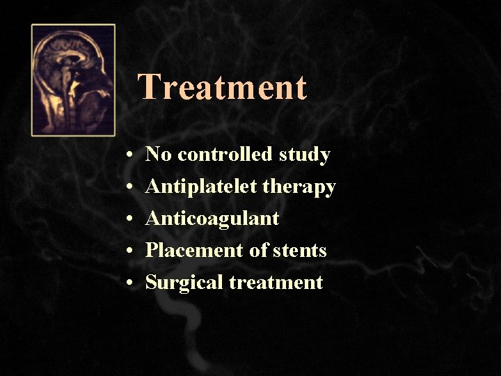 Treatment • • • No controlled study Antiplatelet therapy Anticoagulant Placement of stents Surgical