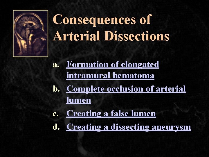 Consequences of Arterial Dissections a. Formation of elongated intramural hematoma b. Complete occlusion of