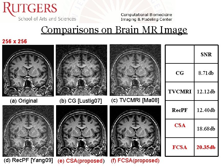 Comparisons on Brain MR Image 256 x 256 SNR (a) Original (b) CG [Lustig Comparisons on Brain MR Image 256 x 256 SNR (a) Original (b) CG [Lustig