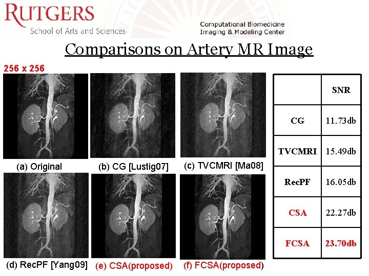 Comparisons on Artery MR Image 256 x 256 SNR (a) Original (b) CG [Lustig Comparisons on Artery MR Image 256 x 256 SNR (a) Original (b) CG [Lustig
