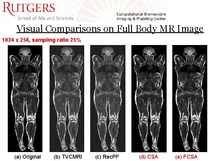 Visual Comparisons on Full Body MR Image 1024 x 256, sampling ratio 25% (a) Visual Comparisons on Full Body MR Image 1024 x 256, sampling ratio 25% (a)