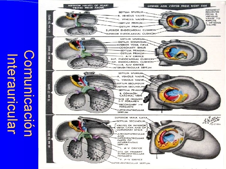 Comunicación Interauricular CARDIO-UAG 