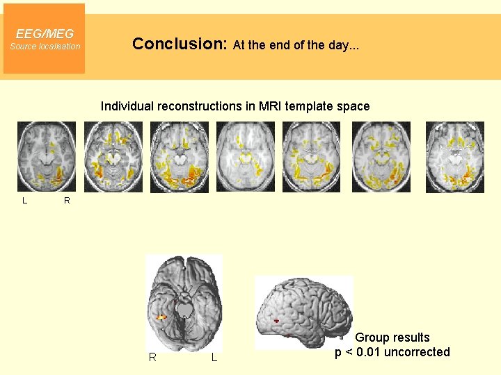 EEG/MEG Source localisation Conclusion: At the end of the day. . . Individual reconstructions