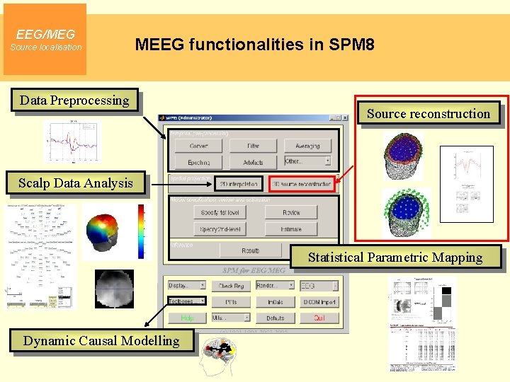 EEG/MEG Source localisation MEEG functionalities in SPM 8 Data Preprocessing Source reconstruction Scalp Data