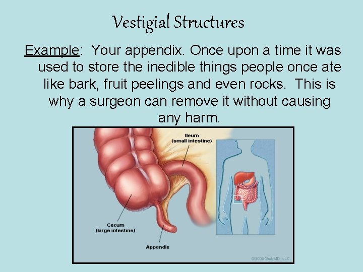 Vestigial Structures Example: Your appendix. Once upon a time it was used to store