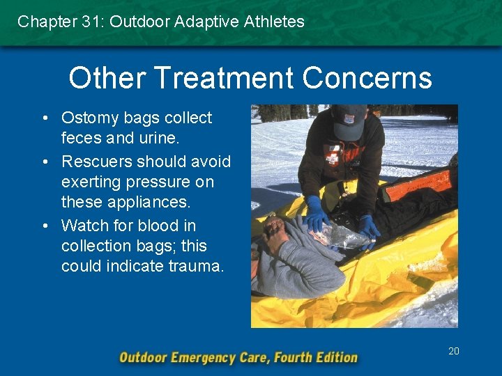 Chapter 31: Outdoor Adaptive Athletes Other Treatment Concerns • Ostomy bags collect feces and