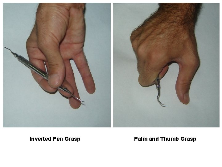 Inverted Pen Grasp Palm and Thumb Grasp 