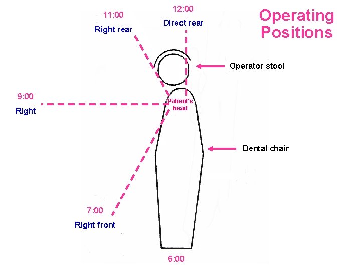 11: 00 Right rear 12: 00 Direct rear Operating Positions Operator stool 9: 00