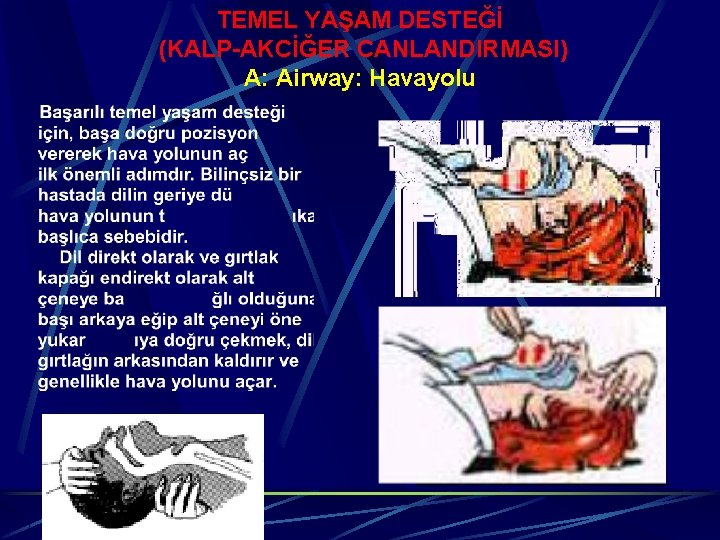 TEMEL YAŞAM DESTEĞİ (KALP-AKCİĞER CANLANDIRMASI) A: Airway: Havayolu 