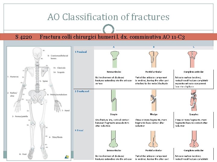 AO Classification of fractures S 4220 Fractura colli chirurgici humeri l. dx. comminutiva AO