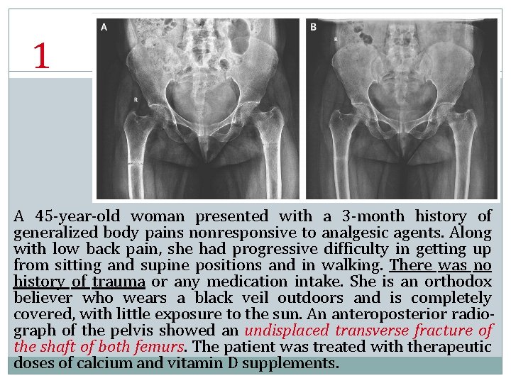 1 A 45 -year-old woman presented with a 3 -month history of generalized body