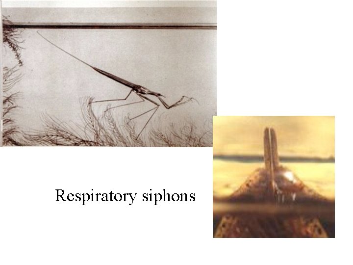 Respiratory siphons 