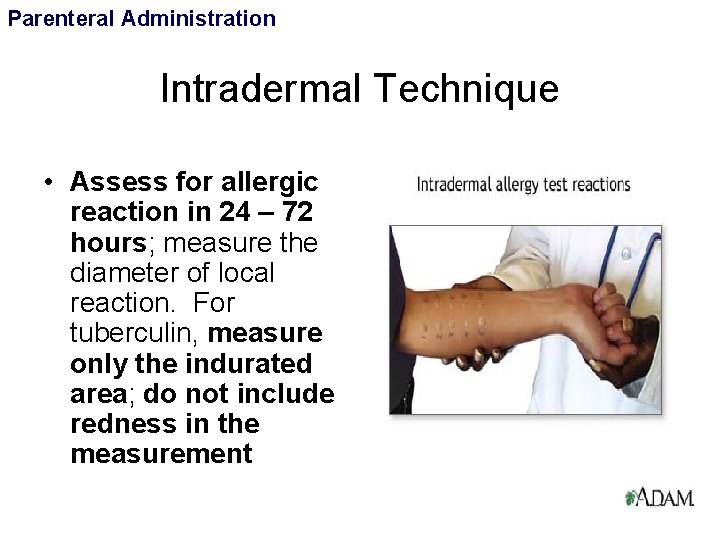 Parenteral Administration Intradermal Technique • Assess for allergic reaction in 24 – 72 hours;