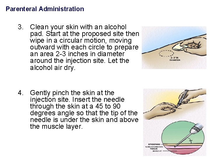 Parenteral Administration 3. Clean your skin with an alcohol pad. Start at the proposed