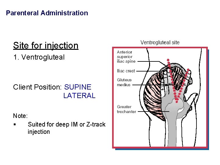 Parenteral Administration Site for injection 1. Ventrogluteal Client Position: SUPINE LATERAL Note: § Suited