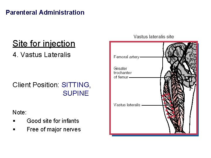 Parenteral Administration Site for injection 4. Vastus Lateralis Client Position: SITTING, SUPINE Note: §